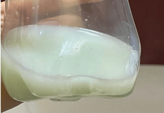 院网站-我的乳汁为啥变绿了？216